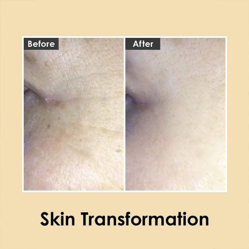 کرم دور چشم حجم دهنده و ضدچروک 9پپتاید و هیالورونیک مدی پیل Medi-Peel Peptide 9 Hyaluronic Volumy Eye Cream