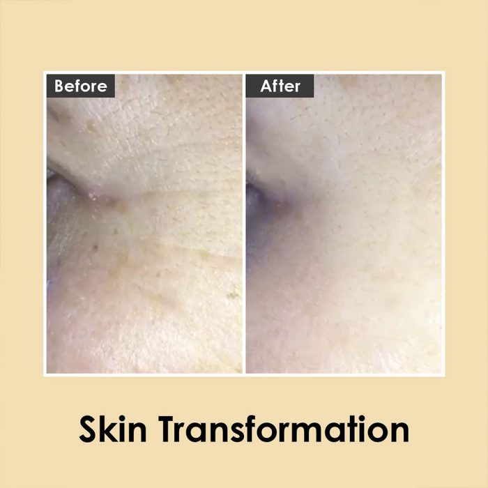 کرم دور چشم حجم دهنده و ضدچروک 9پپتاید و هیالورونیک مدی پیل Medi-Peel Peptide 9 Hyaluronic Volumy Eye Cream