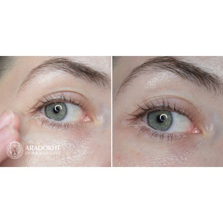 کرم دور چشم ضد چروک 9 پپتاید آکوا اسنس مدی پیل Medi-Peel Peptide 9 Aqua Essence Lifting Eye Cream