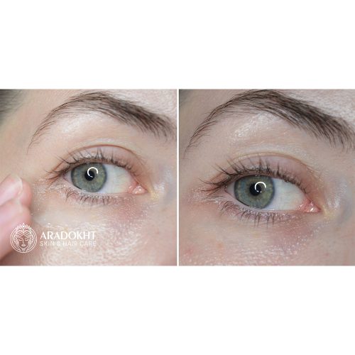 کرم دور چشم ضد چروک 9 پپتاید آکوا اسنس مدی پیل Medi-Peel Peptide 9 Aqua Essence Lifting Eye Cream