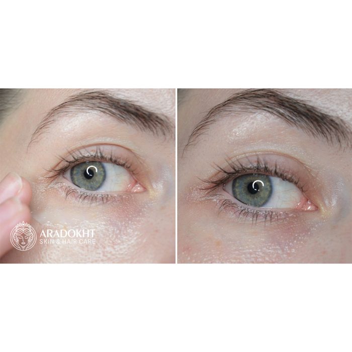 کرم دور چشم ضد چروک 9 پپتاید آکوا اسنس مدی پیل Medi-Peel Peptide 9 Aqua Essence Lifting Eye Cream
