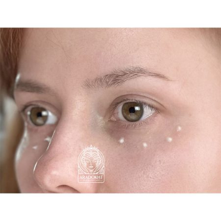 کرم دور چشم ضد چروک و ترمیم کننده سل توکسینگ درما جورس مدی پیل Medi-Peel Cell Toxing Dermajours Repair Eye Cream