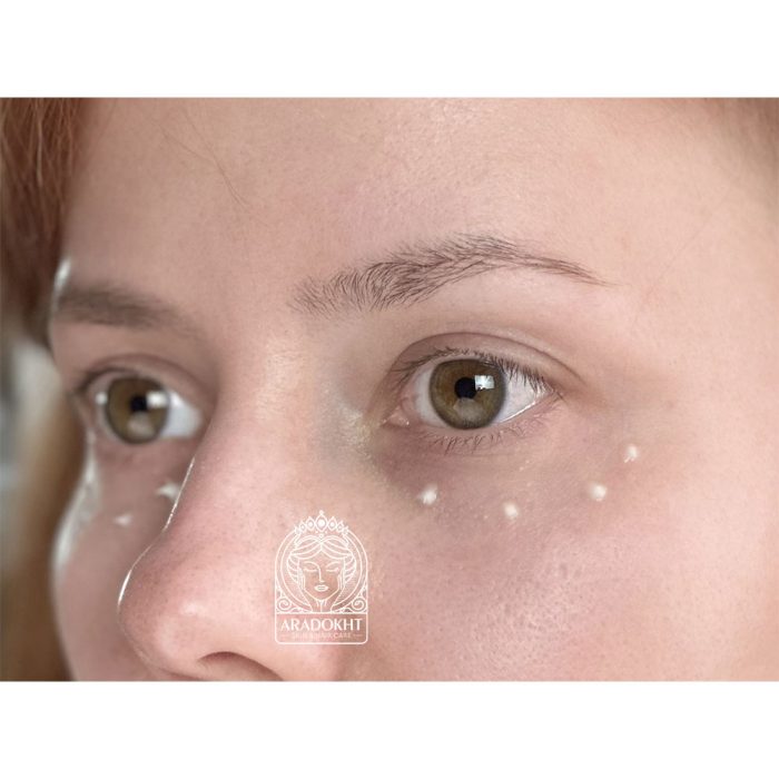 کرم دور چشم ضد چروک و ترمیم کننده سل توکسینگ درما جورس مدی پیل Medi-Peel Cell Toxing Dermajours Repair Eye Cream