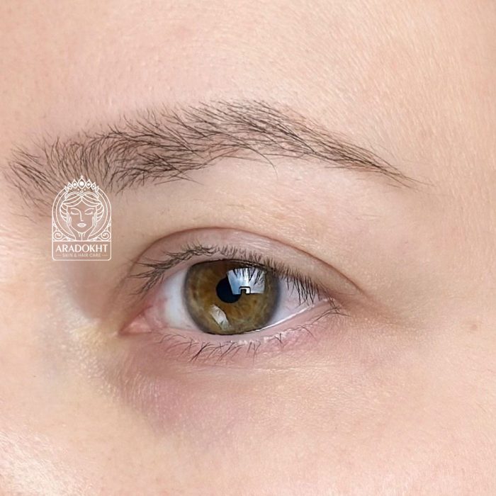 کرم دور چشم ضد چروک و ترمیم کننده سل توکسینگ درما جورس مدی پیل Medi-Peel Cell Toxing Dermajours Repair Eye Cream