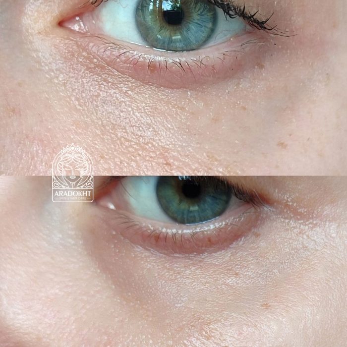 کرم دور چشم ضد چروک و ترمیم کننده سل توکسینگ درما جورس مدی پیل Medi-Peel Cell Toxing Dermajours Repair Eye Cream