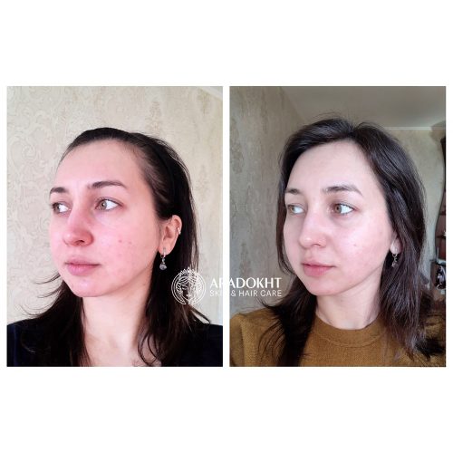 کرم مرطوب کننده پرو بالانس بیوتیک دکتر سراکل Dr. Ceuracle Pro Balance Biotics Moisturizer