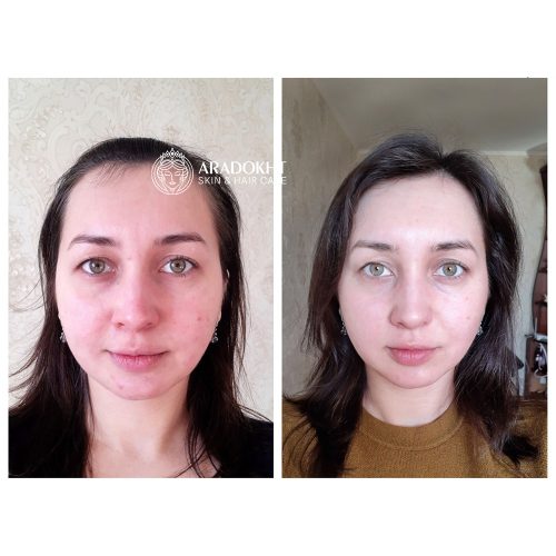 کرم مرطوب کننده پرو بالانس بیوتیک دکتر سراکل Dr. Ceuracle Pro Balance Biotics Moisturizer