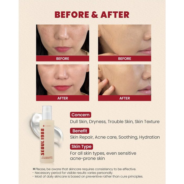 اسنس ترمیم کننده موسین حلزون و برنج سئول 1988 کی سکرت K-SECRET SEOUL 1988 Essence Snail Mucin 97% + Rice
