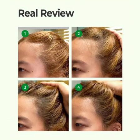تونیک ضد ریزش مو سیکا و پپتاید سام بای می Some By Mi Cica Peptide Anti Hair Loss Derma Scalp Tonic