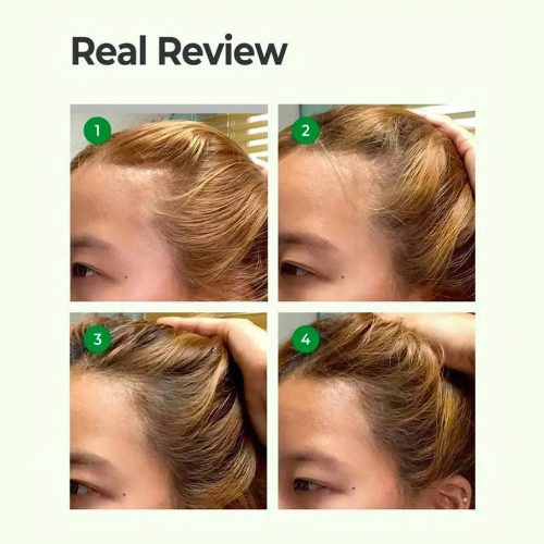تونیک ضد ریزش مو سیکا و پپتاید سام بای می Some By Mi Cica Peptide Anti Hair Loss Derma Scalp Tonic