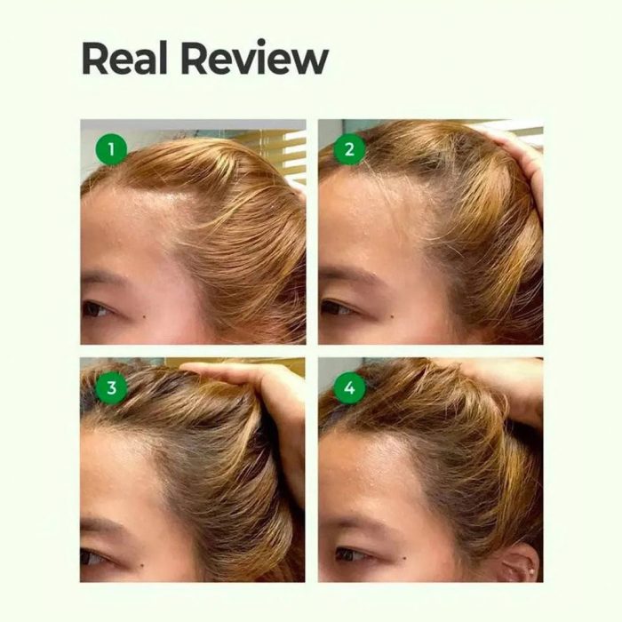 تونیک ضد ریزش مو سیکا و پپتاید سام بای می Some By Mi Cica Peptide Anti Hair Loss Derma Scalp Tonic
