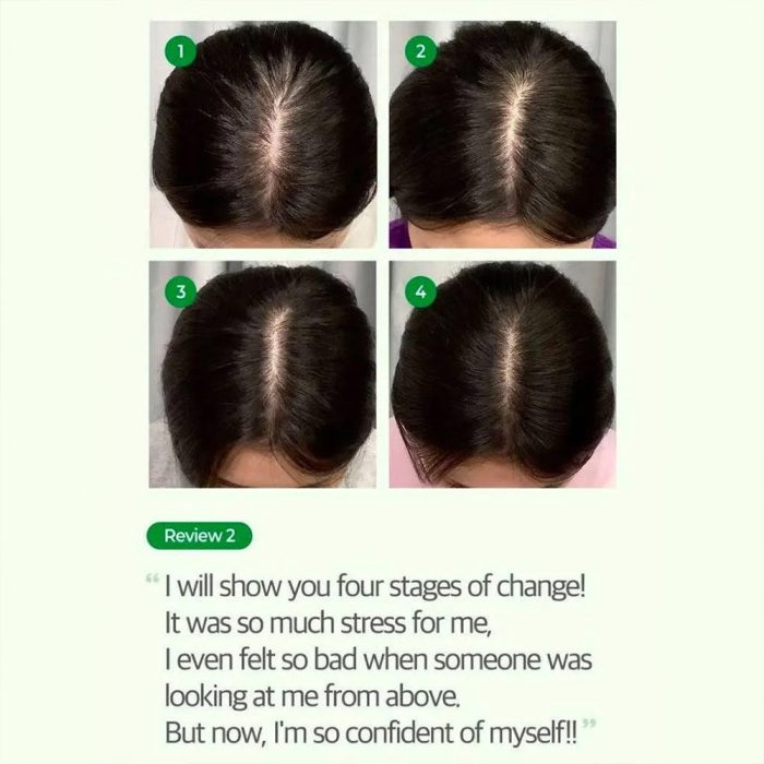 تونیک ضد ریزش مو سیکا و پپتاید سام بای می Some By Mi Cica Peptide Anti Hair Loss Derma Scalp Tonic