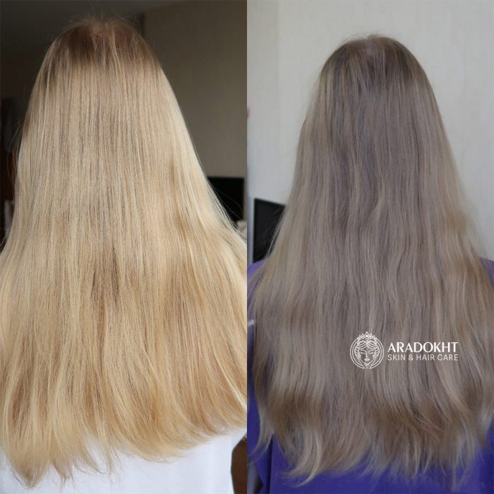 تونیک ضد ریزش مو سیکا و پپتاید سام بای می Some By Mi Cica Peptide Anti Hair Loss Derma Scalp Tonic