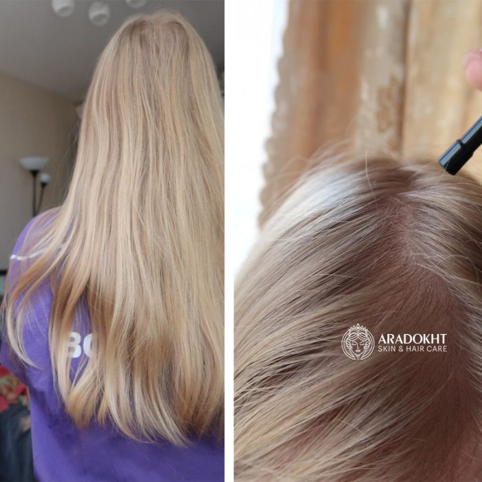 تونیک ضد ریزش مو سیکا و پپتاید سام بای می Some By Mi Cica Peptide Anti Hair Loss Derma Scalp Tonic