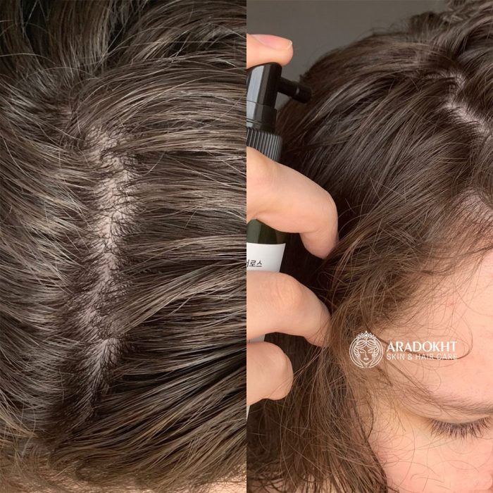 تونیک ضد ریزش مو سیکا و پپتاید سام بای می Some By Mi Cica Peptide Anti Hair Loss Derma Scalp Tonic
