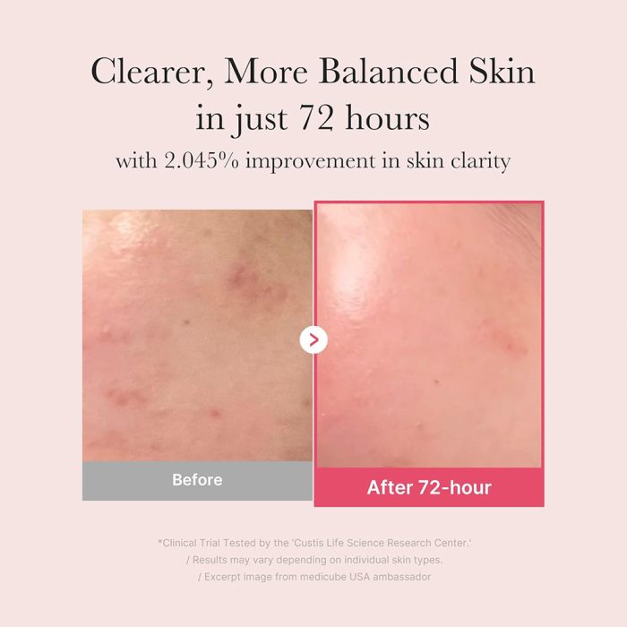 سرم ضد لک و روشن کننده ترانگزامیک اسید و نیاسینامید مدی کیوب MEDICUBE TXA Niacinamide 15% Serum