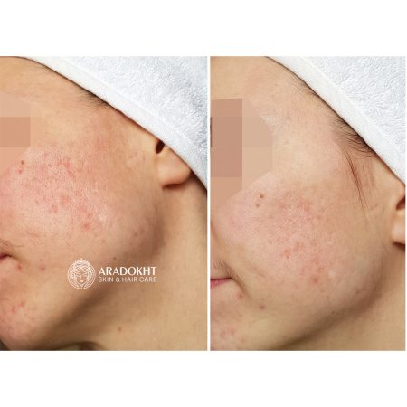 فوم شوینده سیکاپیر دکتر جارت Dr. Jart+ Cicapair Foaming Cleanser