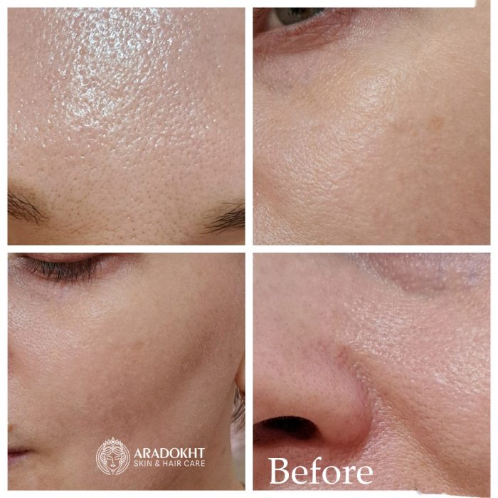 فوم ضد جوش و کنترل منافذ جوش شیرین سلیمکس Celimax Ji.Woo.Gae Baking Soda Deep Pore Foam Cleansing