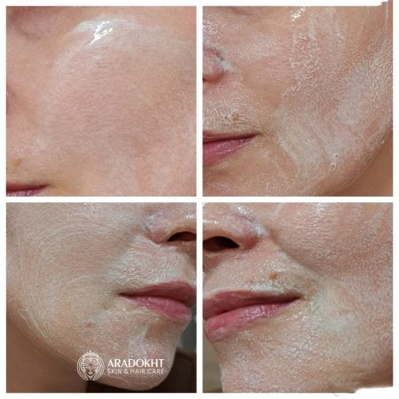 فوم ضد جوش و کنترل منافذ جوش شیرین سلیمکس Celimax Ji.Woo.Gae Baking Soda Deep Pore Foam Cleansing