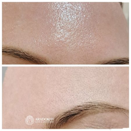فوم ضد جوش و کنترل منافذ جوش شیرین سلیمکس Celimax Ji.Woo.Gae Baking Soda Deep Pore Foam Cleansing