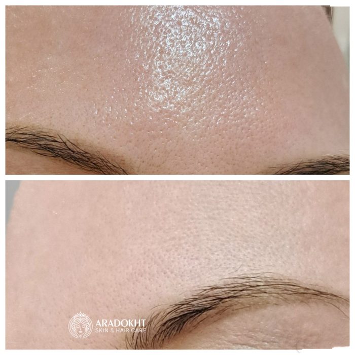 فوم ضد جوش و کنترل منافذ جوش شیرین سلیمکس Celimax Ji.Woo.Gae Baking Soda Deep Pore Foam Cleansing