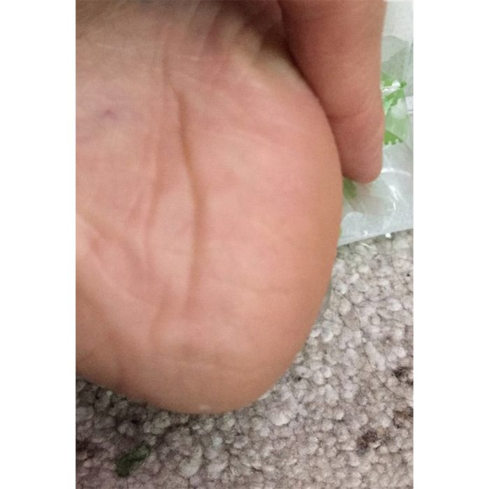ماسک پا لایه بردار پیوردرم مدل پاپایا Purederm Exfoliating Foot Mask