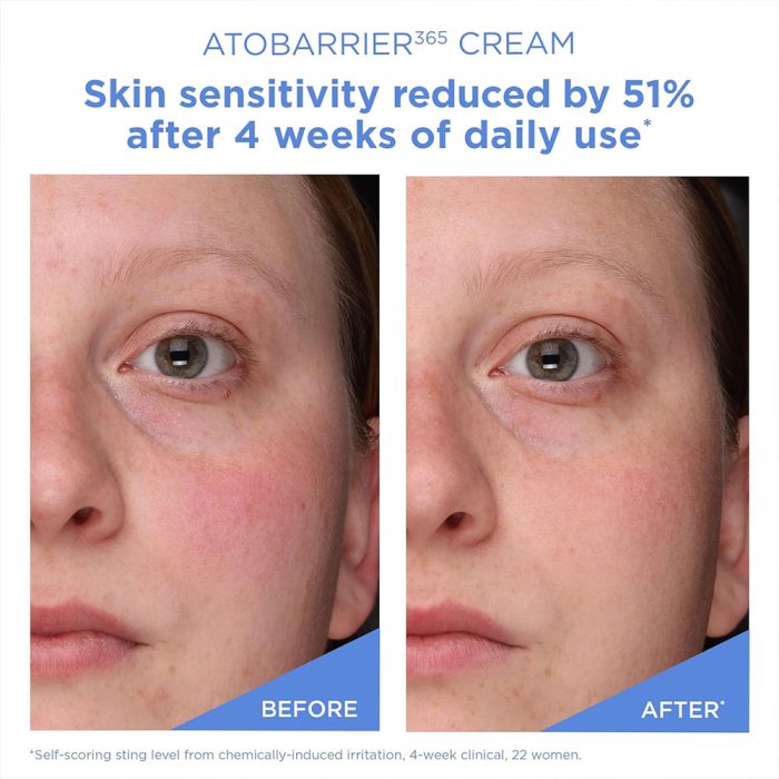 کرم ترمیم کننده و مرطوب کننده قوی اتو بریر 365 استرا Aestura Atobarrier 365 Cream