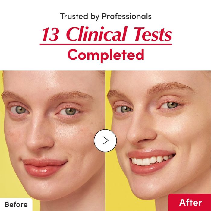 سرم ضد لک و روشن کننده اکوال بری EQQUALBERRY Vitamin Illuminating Serum