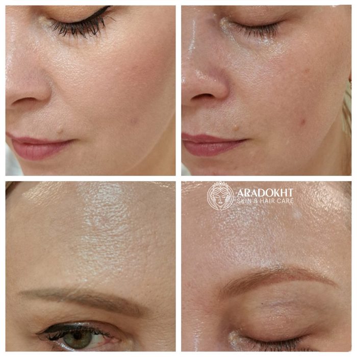 شوینده روغنی ضد جوش سرسیاه جوجوبا سلیمکس Celimax Derma Nature Fresh Blackhead Jojoba Cleansing Oil - Image 7