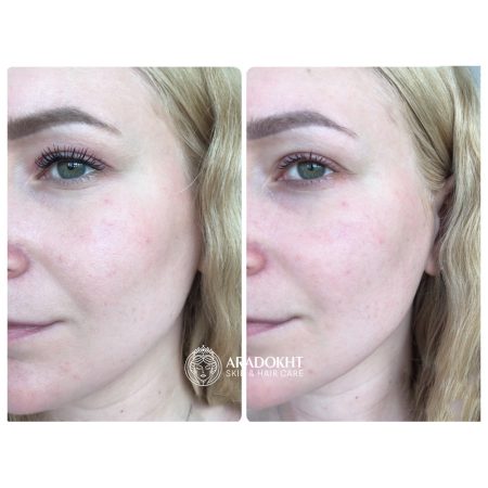 شوینده روغنی ضد جوش سرسیاه جوجوبا سلیمکس Celimax Derma Nature Fresh Blackhead Jojoba Cleansing Oil