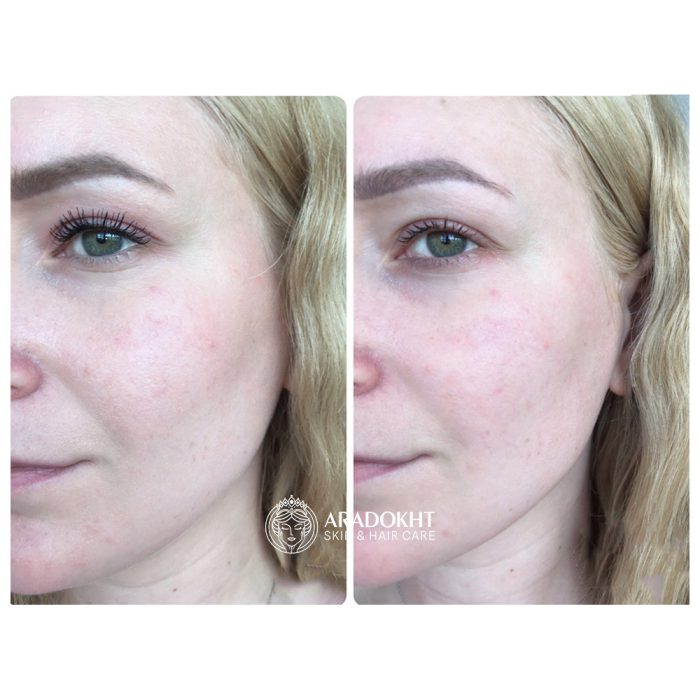شوینده روغنی ضد جوش سرسیاه جوجوبا سلیمکس Celimax Derma Nature Fresh Blackhead Jojoba Cleansing Oil