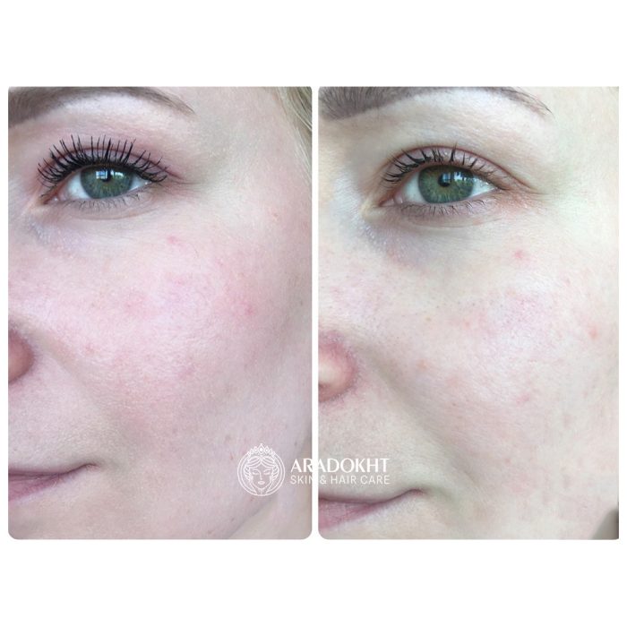 شوینده روغنی ضد جوش سرسیاه جوجوبا سلیمکس Celimax Derma Nature Fresh Blackhead Jojoba Cleansing Oil