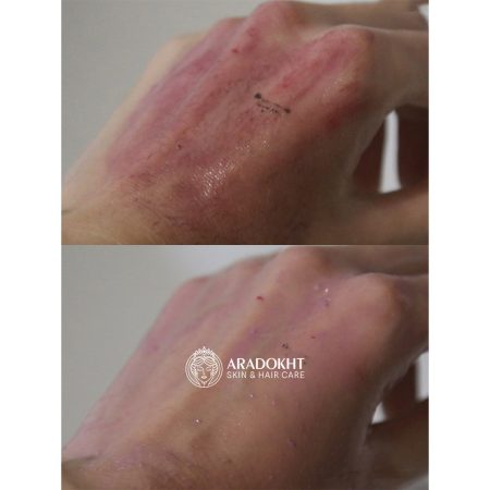 شوینده روغنی ضد جوش سرسیاه جوجوبا سلیمکس Celimax Derma Nature Fresh Blackhead Jojoba Cleansing Oil