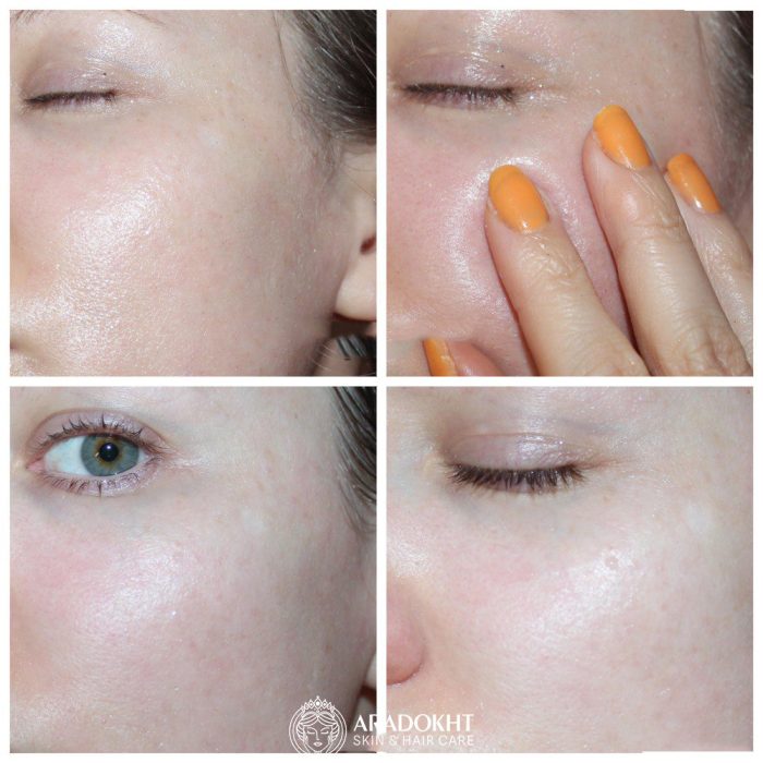 شوینده روغنی ضد جوش سرسیاه جوجوبا سلیمکس Celimax Derma Nature Fresh Blackhead Jojoba Cleansing Oil