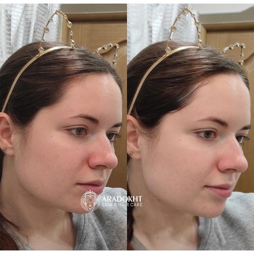 فوم شستشوی درما کلیر دکتر جارت متعادل کننده PH پوست Dr. Jart+ Dermaclear Micro pH Foam