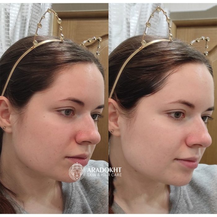 فوم شستشوی درما کلیر دکتر جارت متعادل کننده PH پوست Dr. Jart+ Dermaclear Micro pH Foam