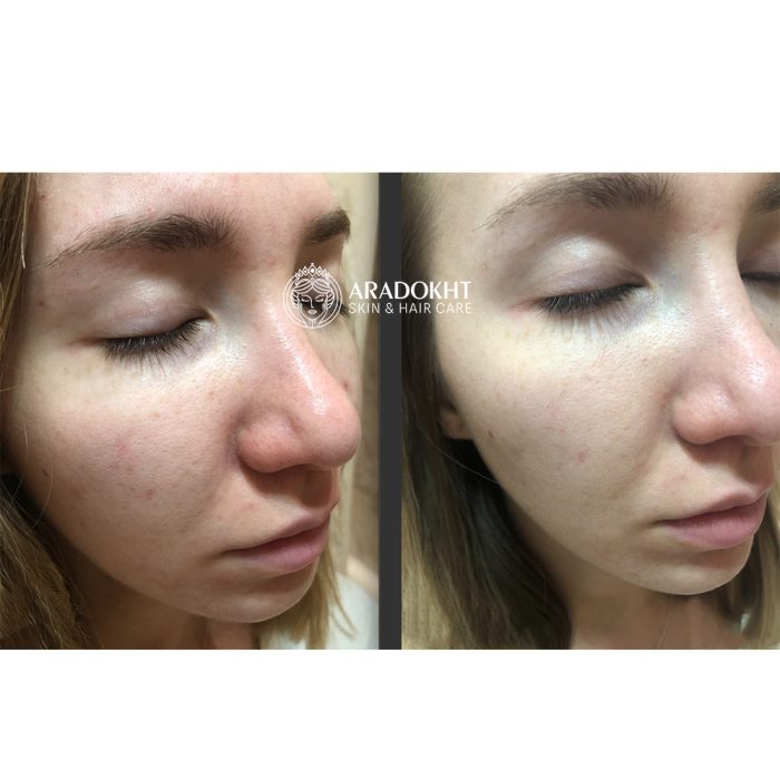 فوم شستشوی درما کلیر دکتر جارت متعادل کننده PH پوست Dr. Jart+ Dermaclear Micro pH Foam
