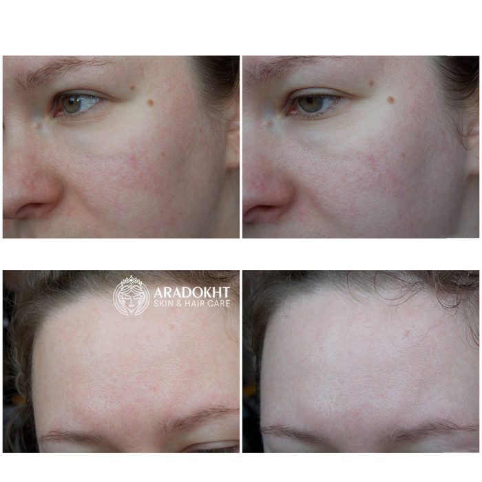فوم شستشوی درما کلیر دکتر جارت متعادل کننده PH پوست Dr. Jart+ Dermaclear Micro pH Foam