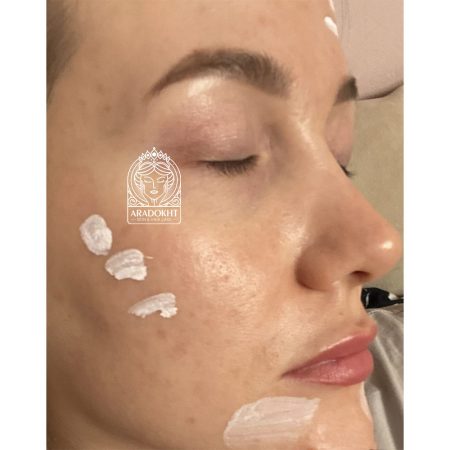 محلول ضد جوش و تسکین دهنده تی تری دکتر جارت Dr. Jart+ Ctrl-A Teatreement Soothing Spot