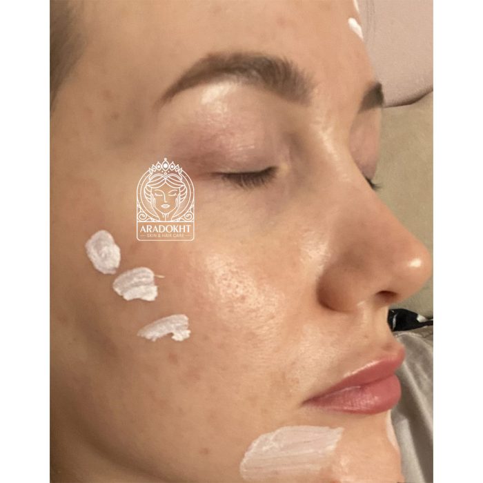 محلول ضد جوش و تسکین دهنده تی تری دکتر جارت Dr. Jart+ Ctrl-A Teatreement Soothing Spot
