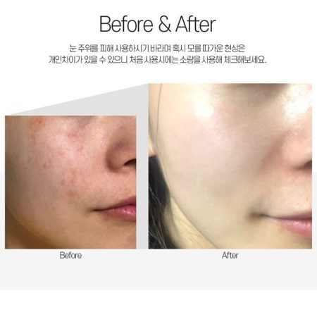 مزو کرم تسکین دهنده و ترمیم کننده سنتلا مدی پیل Medi-Peel Centella Mezzo Cream