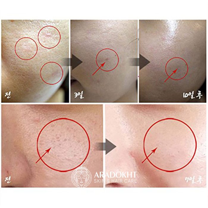 مزو کرم تسکین دهنده و ترمیم کننده سنتلا مدی پیل Medi-Peel Centella Mezzo Cream