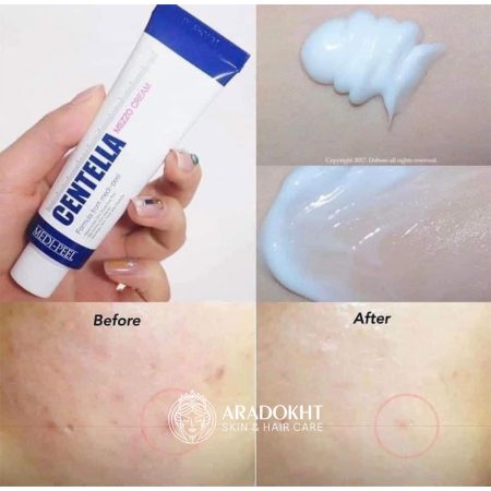 مزو کرم تسکین دهنده و ترمیم کننده سنتلا مدی پیل Medi-Peel Centella Mezzo Cream