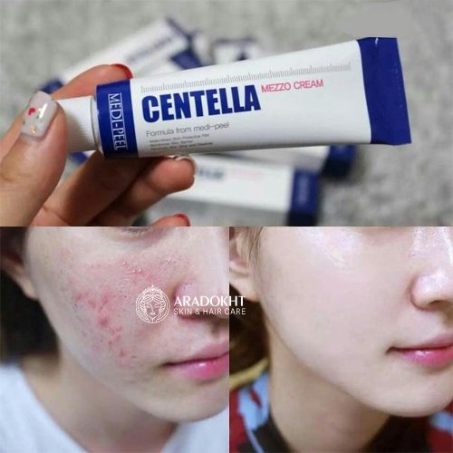 مزو کرم تسکین دهنده و ترمیم کننده سنتلا مدی پیل Medi-Peel Centella Mezzo Cream