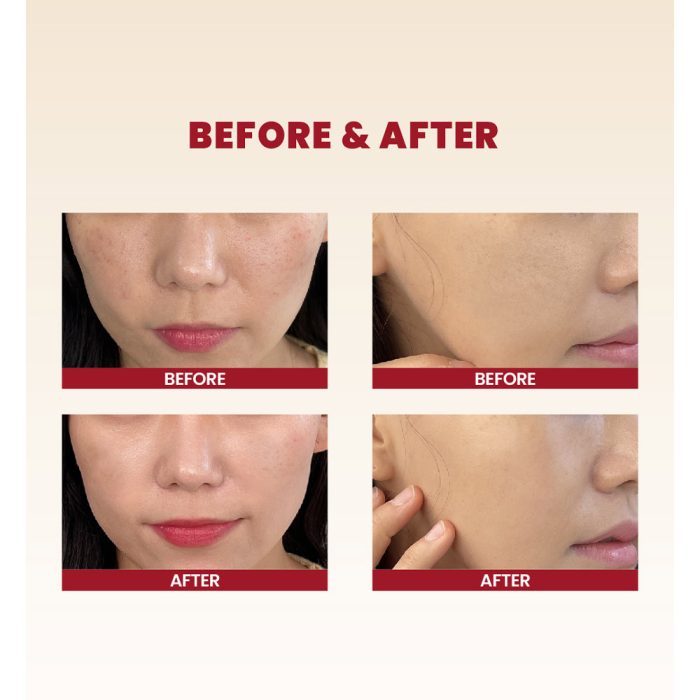 کرم موسین حلزون 93% و برنج کی سکرت تسکین دهنده و مرطوب کننده قوی پوست K-SECRET SEOUL 1988 Cream Snail Mucin 93% + Rice