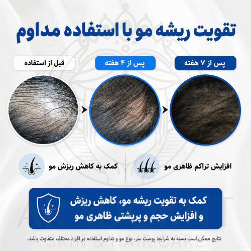 سرم ضد ریزش و تقویت کننده ریشه مو سی پوری Seapuri Scalpy Hair Serum