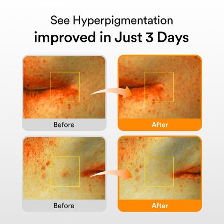 سرم ضد لک و روشن کننده گلوتاتیون ابیب Abib Glutathiosome Dark Spot Serum Vita Drop