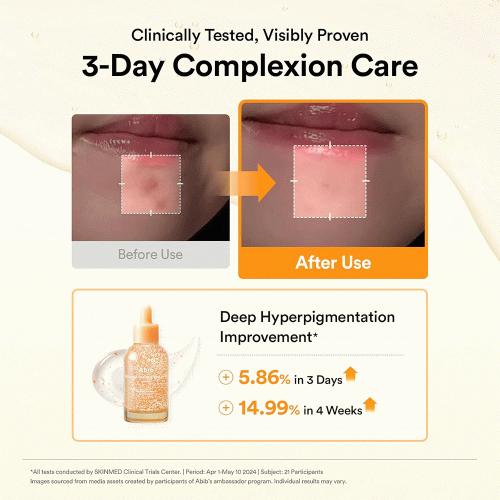 سرم ضد لک و روشن کننده گلوتاتیون ابیب Abib Glutathiosome Dark Spot Serum Vita Drop