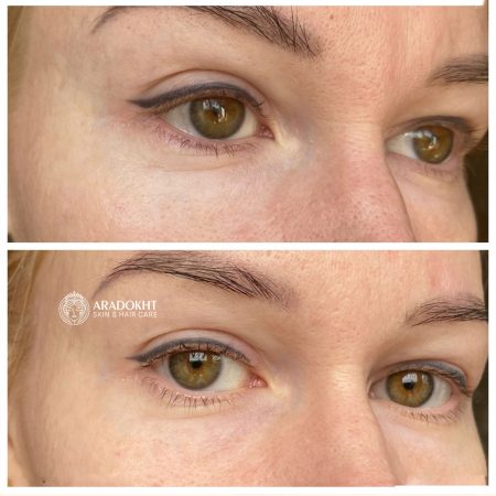 پک اختصاصی دور چشم ترانگزامیک اسید و گواشا مری اند می Mary & May Glutathione Eye Cream Kit