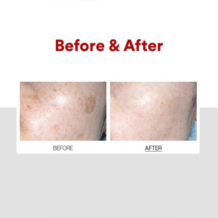 کرم ضد لک و روشن کننده ملانون ایکس مدی پیل MEDI-PEEL Melanon X Cream
